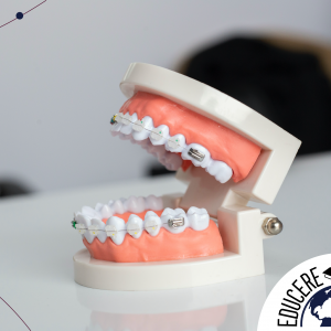 Diplomado en Ortodoncia y Autoligado Essentials